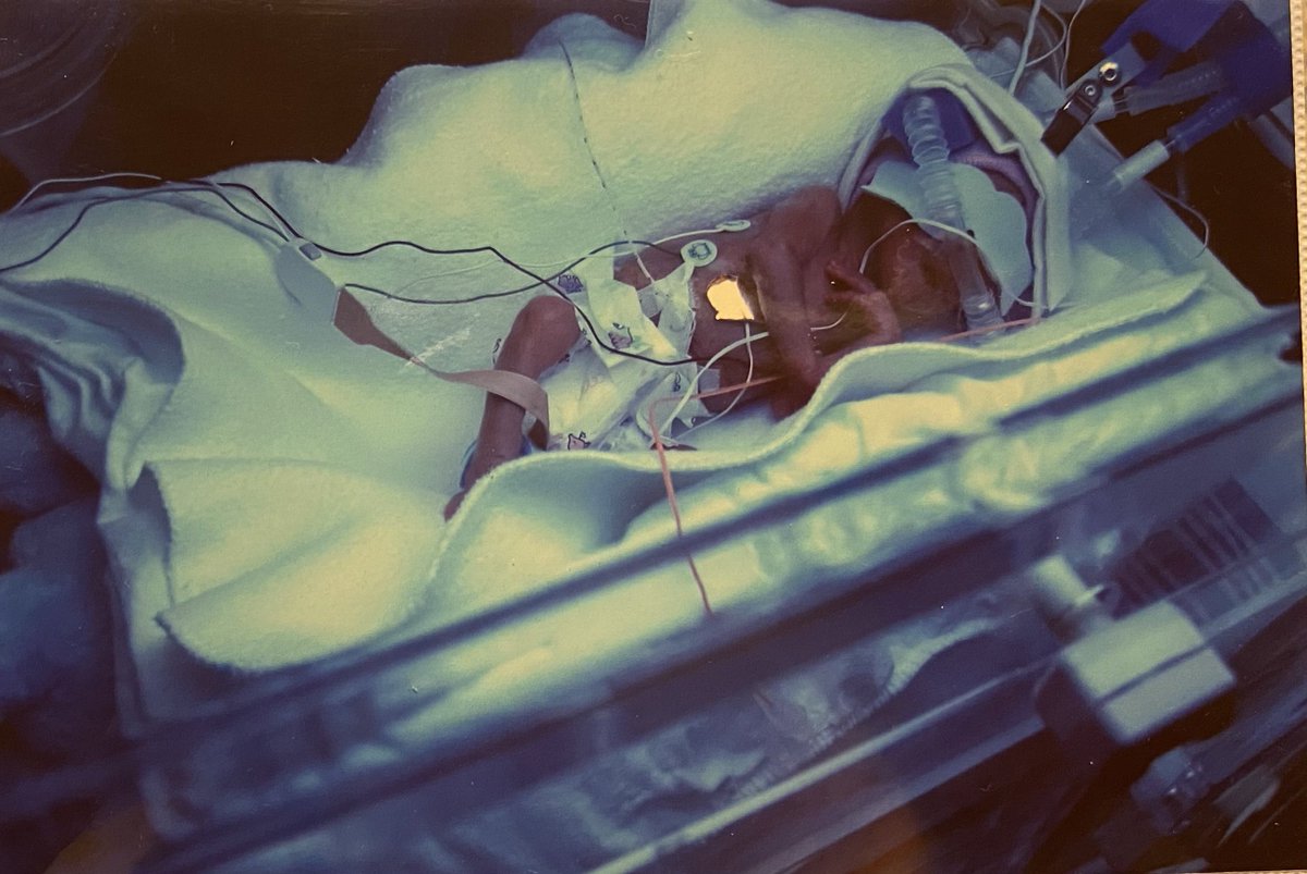 These 2 made it to 18! Every year on this day I give thanks you <a href="/BrighamWomens/">Brigham and Women's Hospital</a> and especially Kathy, Marcia, and Becky - our NICU angels aka nurses.