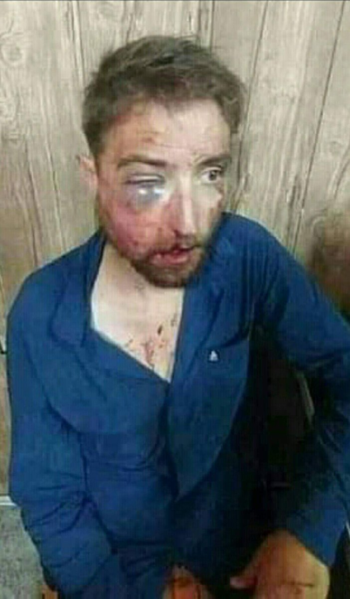 پیٹرول پمپ پر عمران خان زندہ باد نعرہ لگانے والے کی حالت