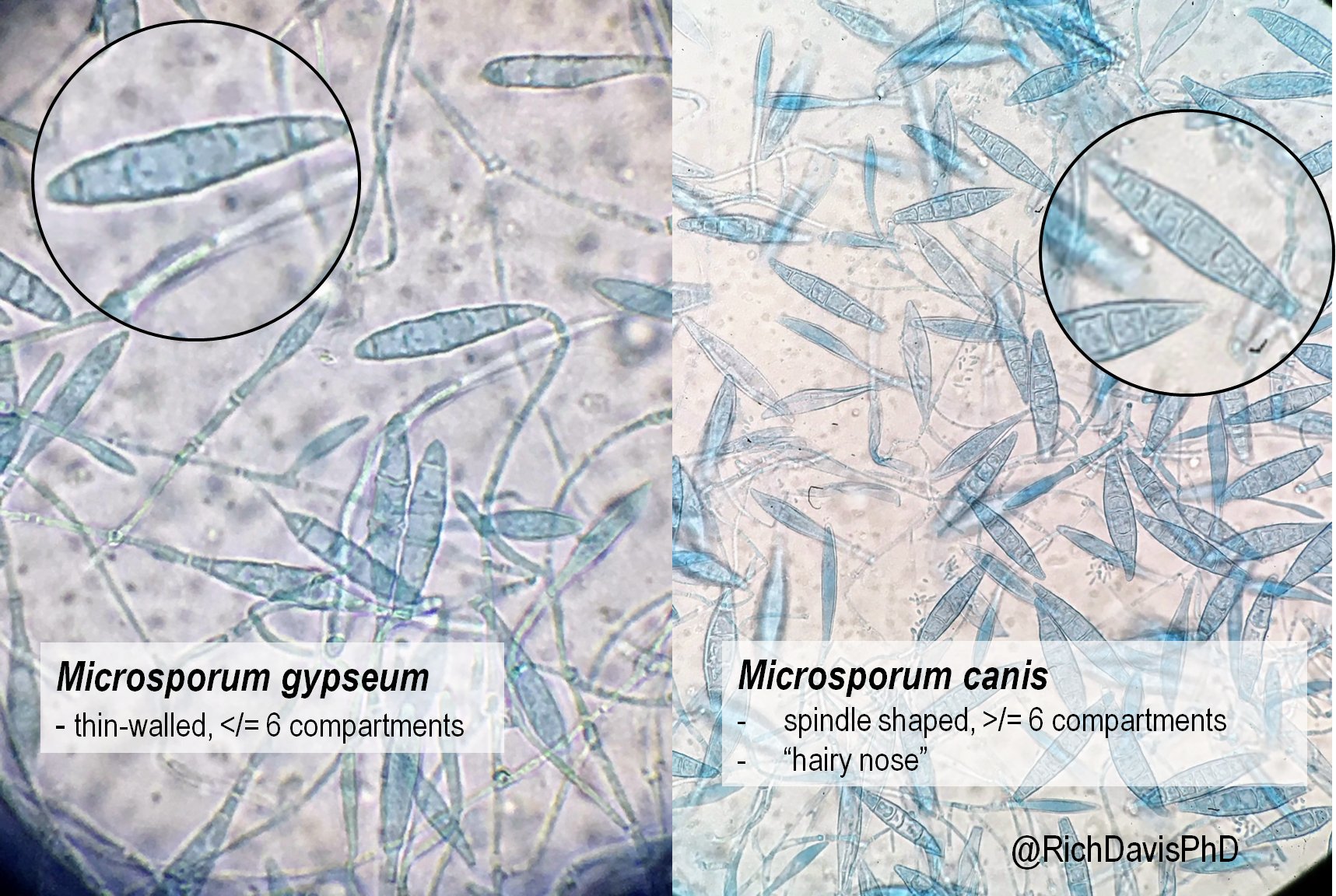 Microsporum Canis