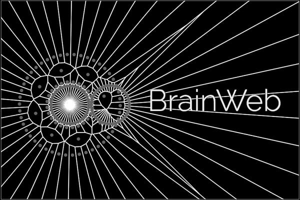 brainhackorg's tweet photo. Project.10. Making Of BrainWeb by @katjaQheuer
@R3rt0 @RemiGau @neurabenn @complexbrains
https://t.co/Qd9tHp4o7H
@brainhackorg #brainhackglobal2020ππ§ π¨πΌβπ»π©πΏβπ» https://t.co/0asBDzyWQQ