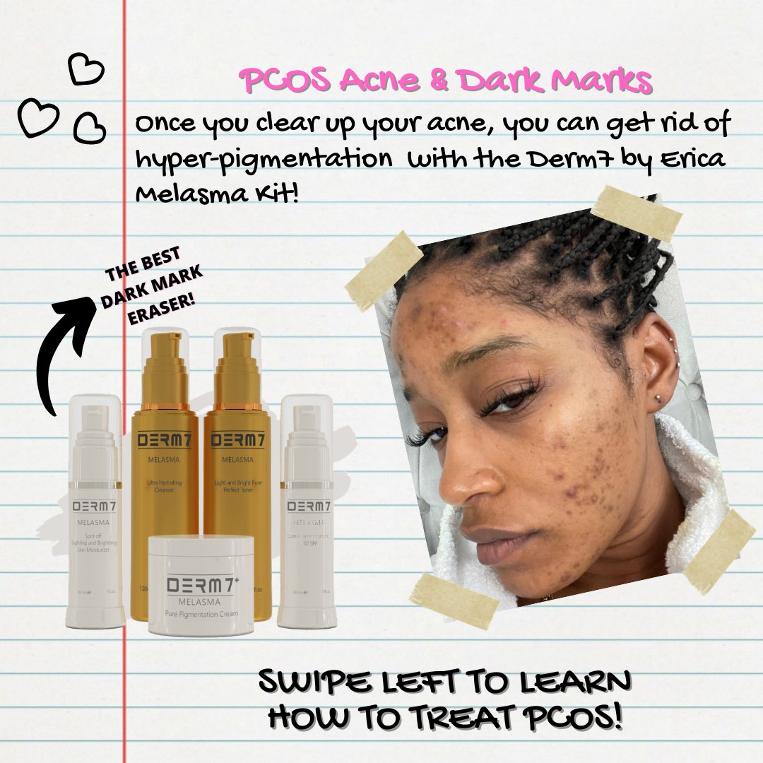 Derm7byErica's tweet photo. https://t.co/0ehYg6Z7Wf