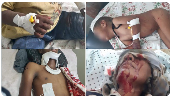 6. 𝐌𝐚𝐬𝐬 𝐦𝐮𝐫𝐝𝐞𝐫  #Tigray|an civilians are going through a daily bombings from warplanes & heavy artilleries. According to credible reports, especially the youth are being targeted. 67 in Zalambessa, 99 in Shire & 27 in Mekelle on Nov 28th are few examples.