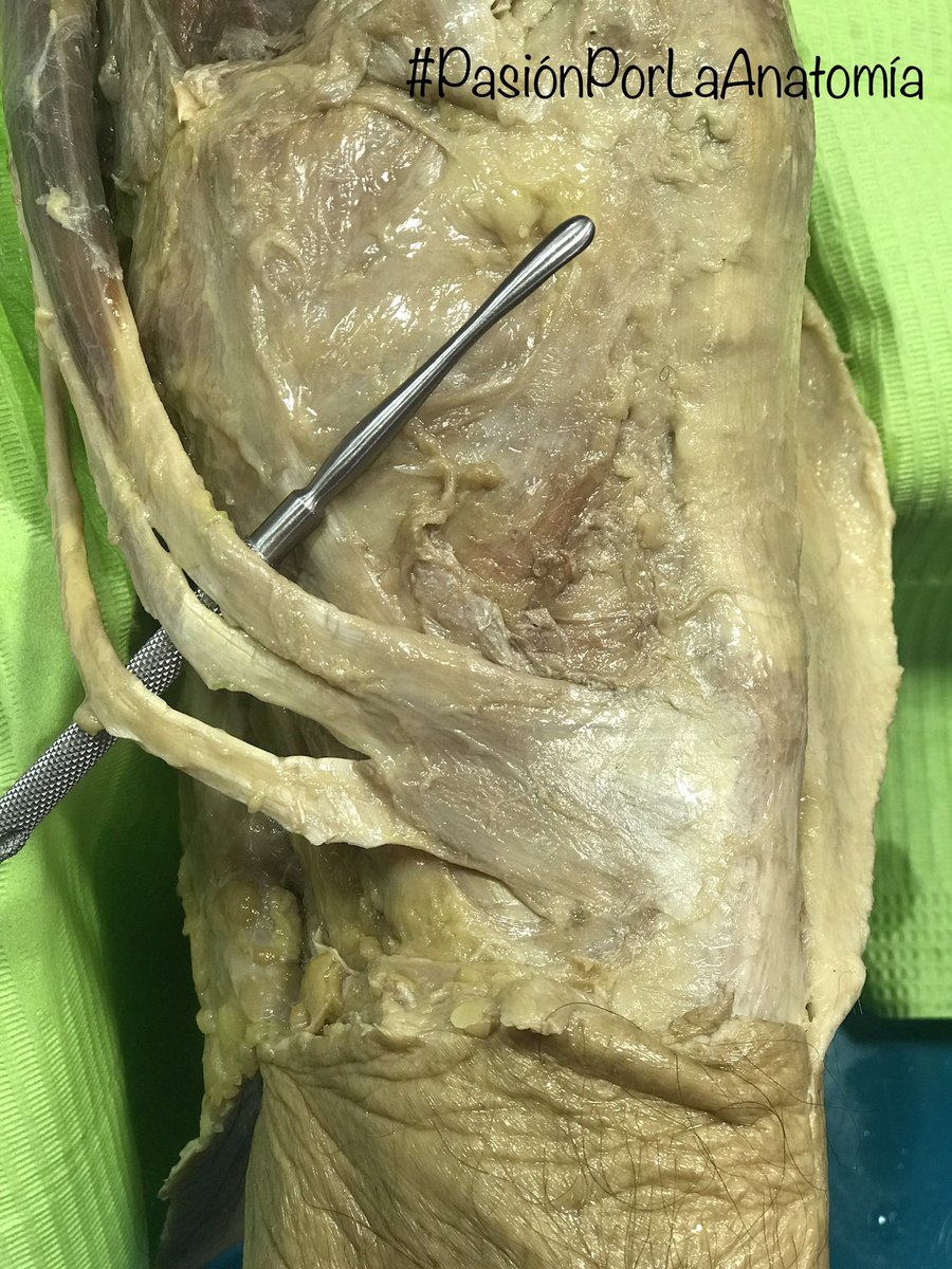 PasionAnatomia's tweet photo. Pata de ganso (𝘗𝘦𝘴 𝘢𝘯𝘴𝘦𝘳𝘪𝘯𝘶𝘴)
👉 Músculo sartorio
👉 Músculo semitendinoso 
👉 Músculo grácil https://t.co/vxmeXcrkCT