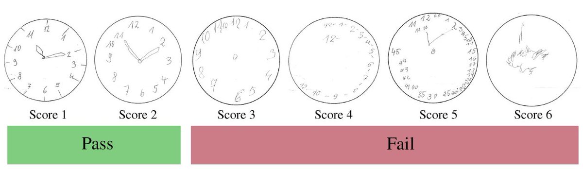 maier_ak's tweet photo. #DeepLearning reveals Dementia in Clock Drawings:
https://t.co/i9AQngv6i4

@SpirosMargaris @antgrasso @SwissCognitive @Montreal_AI @ipfconline1 @Ronald_vanLoon @MikeQuindazzi @andy_fitze @jblefevre60 @KirkDBorne @evankirstel @Marktechpost @DrJDrooghaag https://t.co/dJ7JUVOAfY