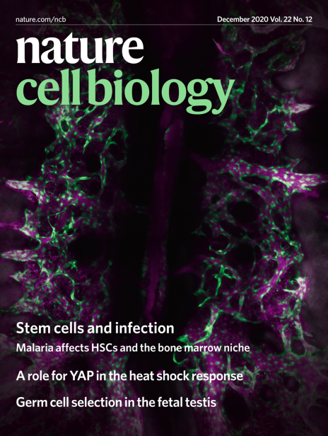 NatureCellBio's tweet photo. The last edition of 2020 is out!
📝#Xchromosome in #hPGCs
📝#HSC niche alteration during infection
📝FACT controls #HSC
📝#GermCells are removed via #apoptosis
📝#YAP controls #HeatShock
📝#ActinPolymerization during #ReplicationStress
Read more: https://t.co/z4KzeYOA8y https://t.co/s6sVD0SPBH