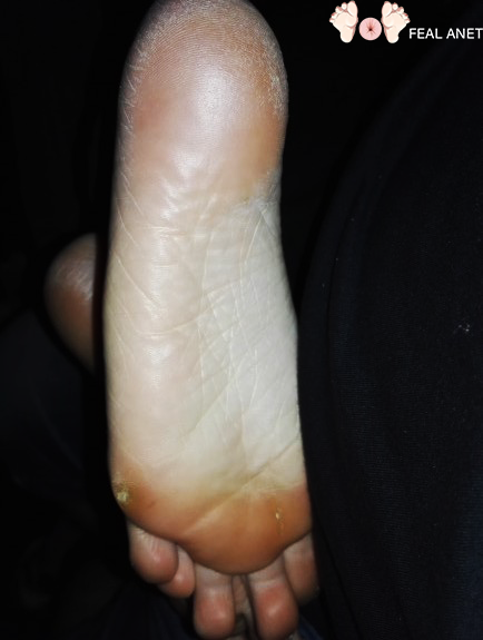 Petite soles https://t.co/FuKgDUbRNC