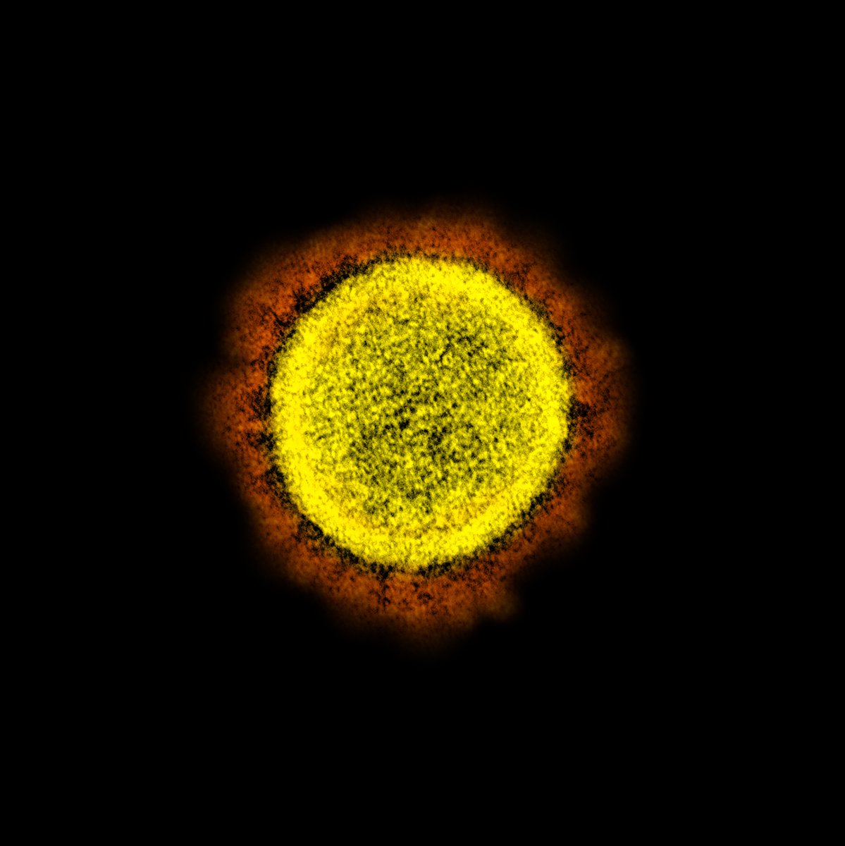 An image showing a particle of SARS-CoV-2, the virus which causes COVID-19.