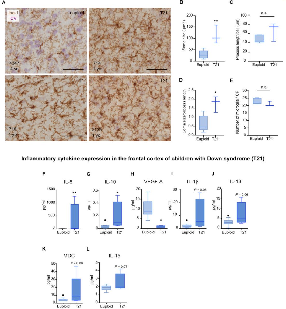 2. Microglial cells from children with DS (1–10 years) displayed increased soma size and higher soma size-to-process length ratio. IL-8 and IL-10 levels were significantly higher, while VEGF-A was lower in children with DS