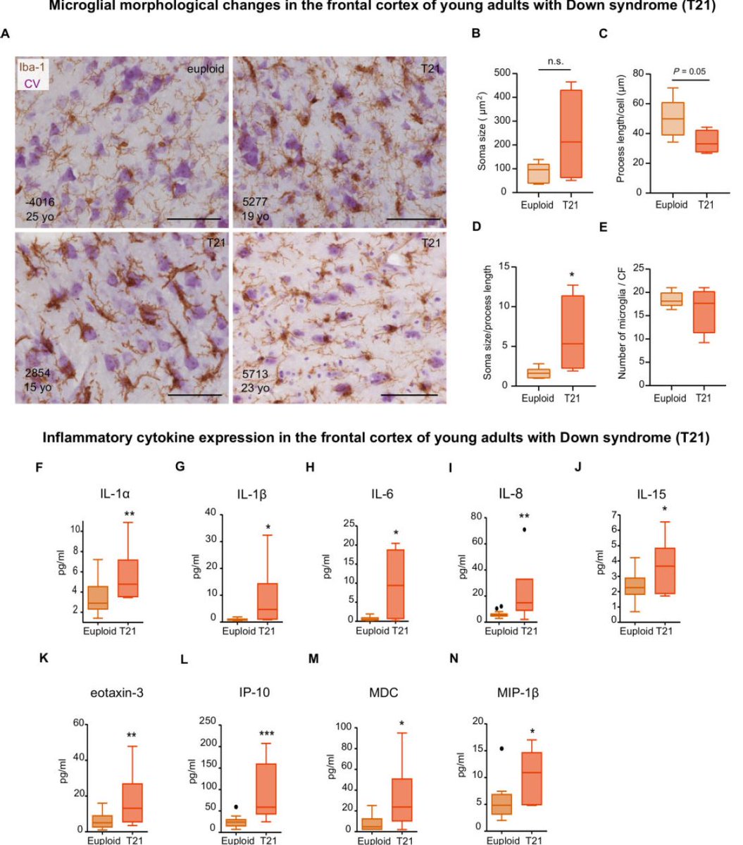 3. Young individuals with DS (13-25 years) also displayed a higher soma size-to-process length ratio and increased cortical levels of IL-8, IL-1a, IL-1b, IL-6, IL-15, eotaxin-3, IP-10, MDC, and MIP-1b
