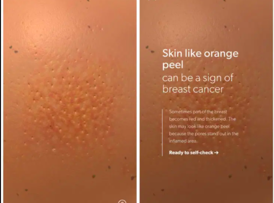 Breat Cancer Awareness tweet media