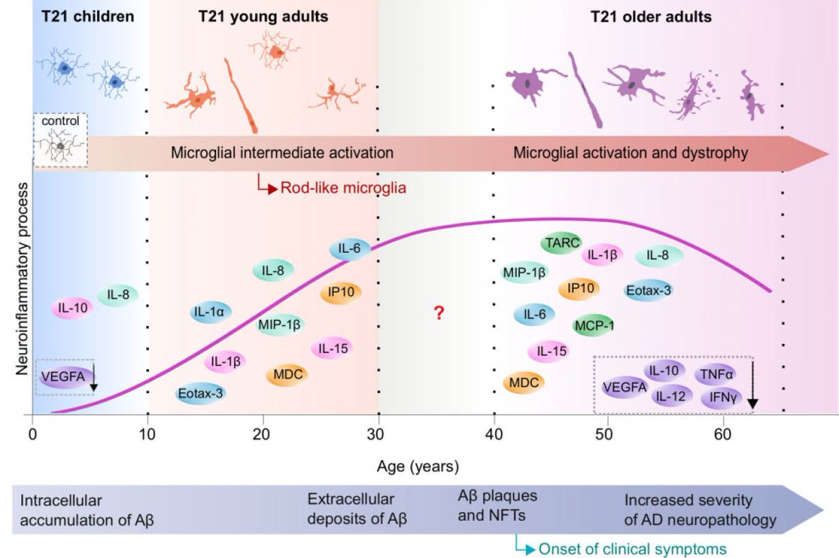 In this comprehensive study we report a differential neuroinflammatory process across the lifespan of individuals with Down syndrome (DS). Key inflammatory mediators are exacerbated before the occurrence of overt  #Alzheimer's disease pathology and wane at advanced stages.