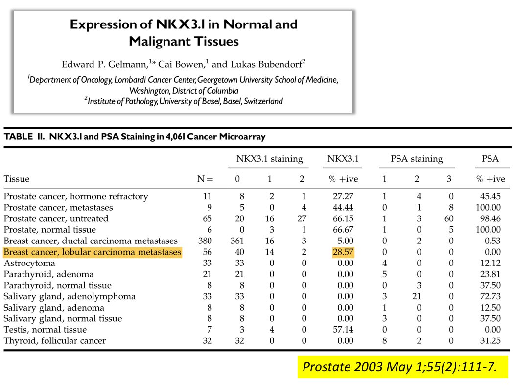 8/ Fun fact  Did you know that the well-known prostate-specific IHC marker NKX3.1 is positive in 25-28% av lobular breast carcinomas also? Say what 
