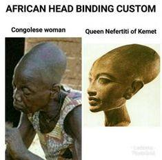 Africa | Creating the Aristocratic Pointed Head | Baby Mangbetu Skull Shaping. Congo | 1929 Print