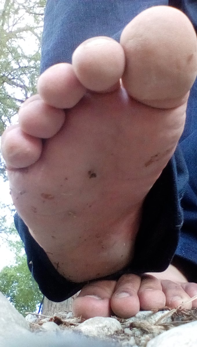 wolfoots's tweet photo. This is how my foot remains after I walked barefoot for a while in the park.

#barefoot #barefeet #foot #feet #pies #pie #descalzo #toes #sole #fotography #fotografia #pic https://t.co/WtPcGCH1Zb