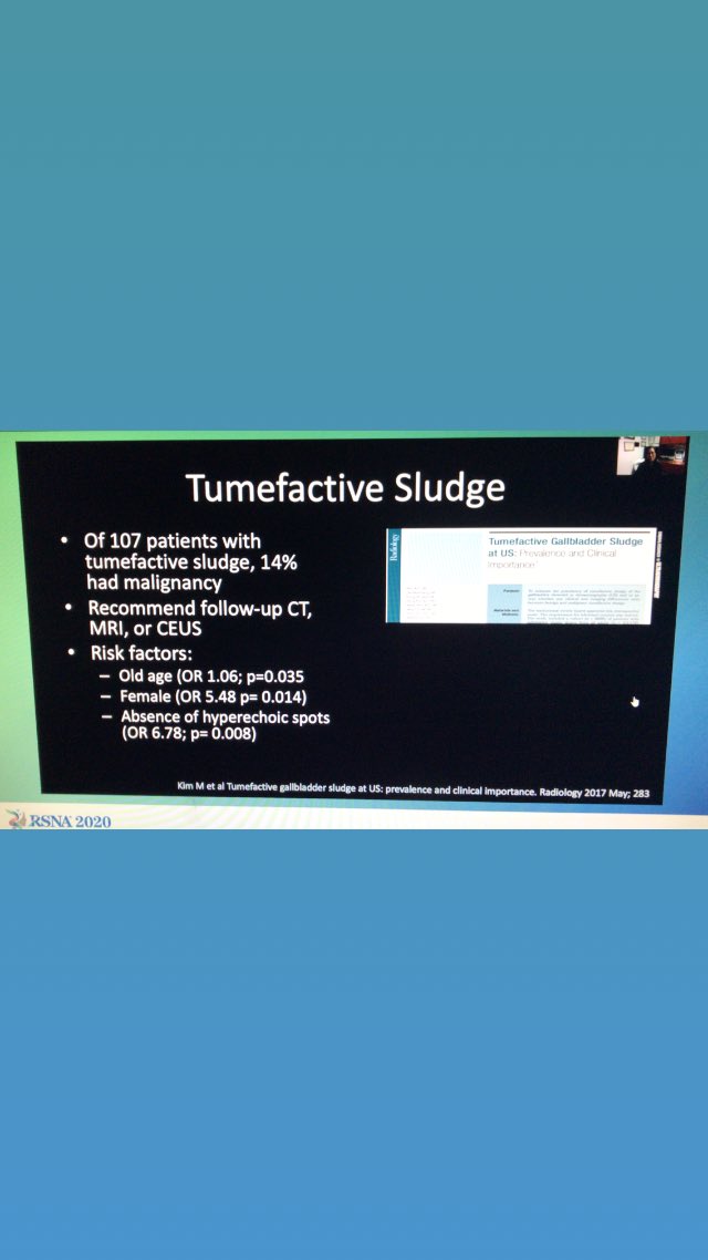 Jade Wong (@jadejwong) on Twitter photo Beware of tumefactive sludge! Can be associated with malignancy. #@ayakamaya, <a href="/sruradiology/">SRU Radiology</a> @rsna2020 Beware of tumefactive sludge! Can be associated with malignancy. #@ayakamaya, <a href="/sruradiology/">SRU Radiology</a> @rsna2020