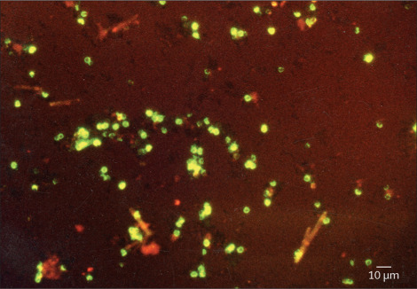 K42H's tweet photo. Check out our @TheLancetInfDis paper showing  that LED-microscopy and non-refrigerated rapid test have good diagnostic accuracy for #cryptosporidium infection. Great collaboration between @UiB @JimmaUniv @haukeland_no @uni_copenhagen @SykehusVestfold and @UniNMBU https://t.co/xxdmQBYpEH