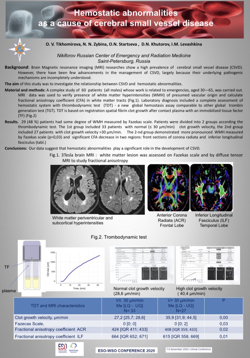 Our poster at the ESO-WSO congress 2020 #esowso2020
