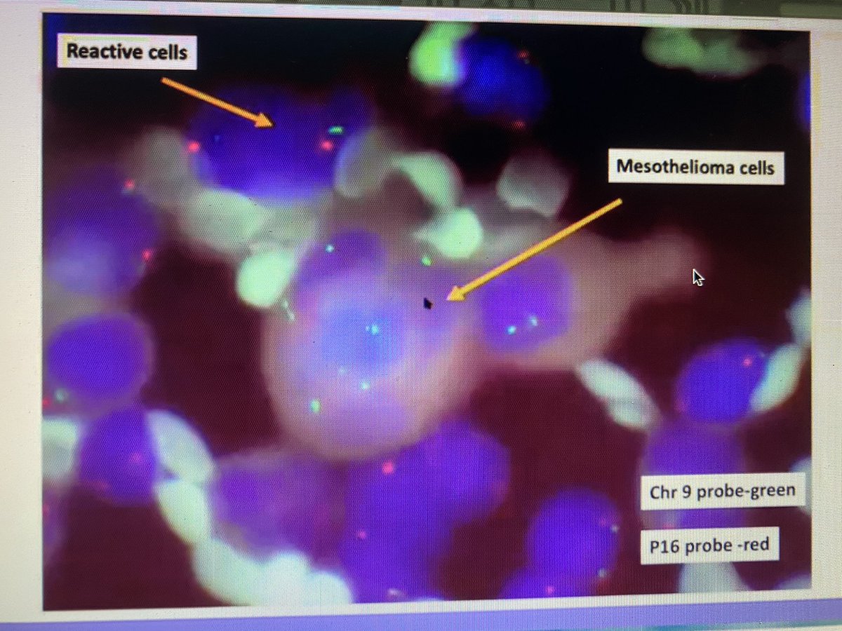 can blood test detect covid 19 vaccine