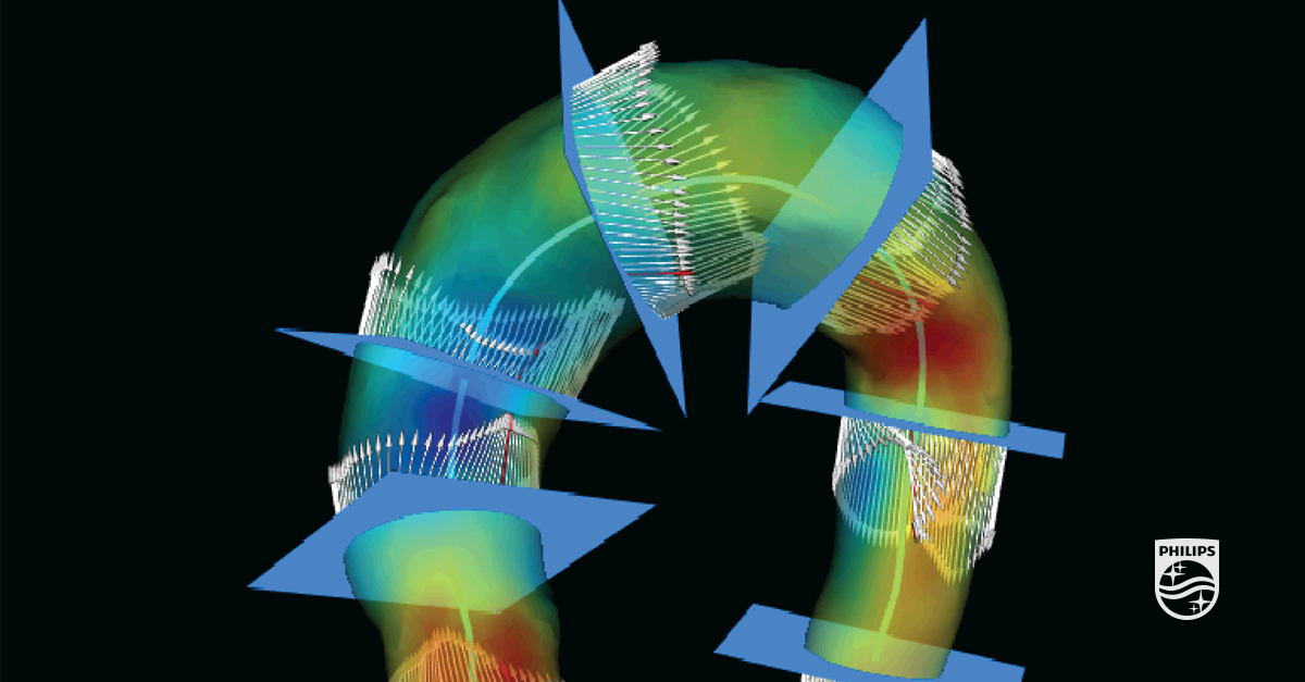 Automatisierte Auswertung von CT- &amp; MR-Scans, optimierter Befundprozess dank Analysetools, standort- und fachbereichsübergreifender Austausch – die @muenchenklinik nutzt die #Radiologie-IT-Lösung #IntelliSpace Portal von #Philips. Mehr im @RadiologieMag: to.philips/6018Hz7mG