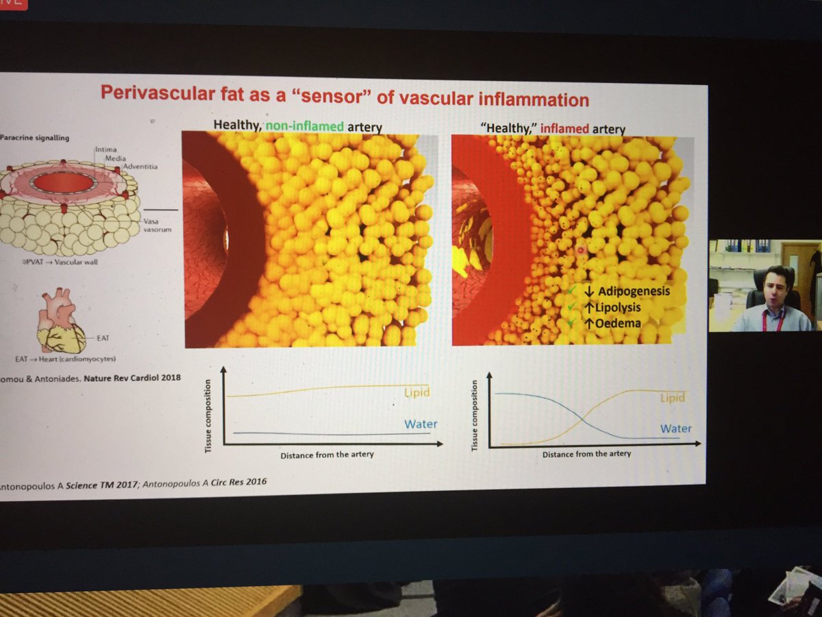Charalambos Antoniades now reviews imaging endpoints in atherosclerosis and also inflammatory residual risk. Not only plaque burden but also Fat Attenuation Index of the perivascular adipose tissue