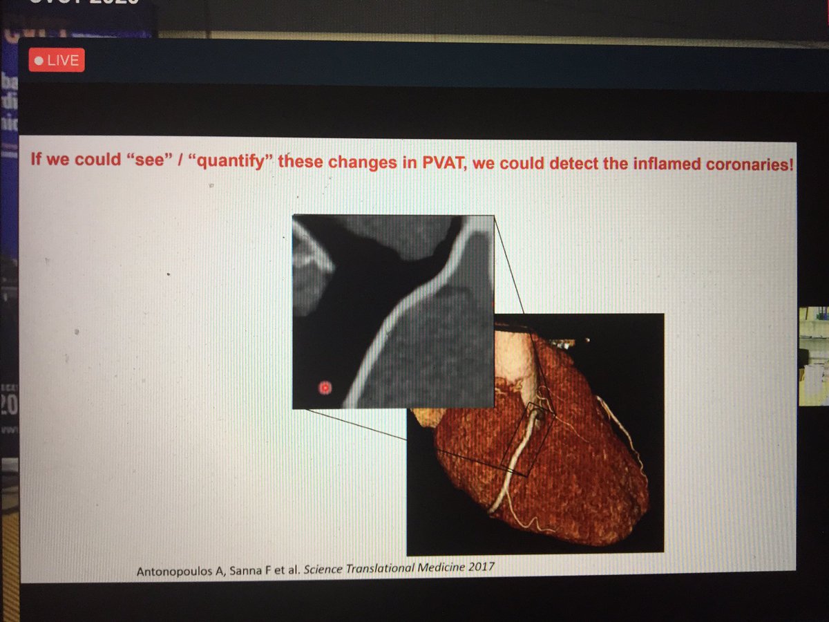 Charalambos Antoniades now reviews imaging endpoints in atherosclerosis and also inflammatory residual risk. Not only plaque burden but also Fat Attenuation Index of the perivascular adipose tissue