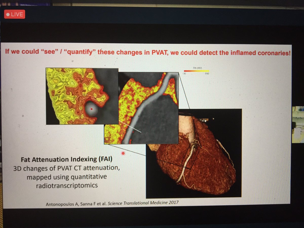 Charalambos Antoniades now reviews imaging endpoints in atherosclerosis and also inflammatory residual risk. Not only plaque burden but also Fat Attenuation Index of the perivascular adipose tissue
