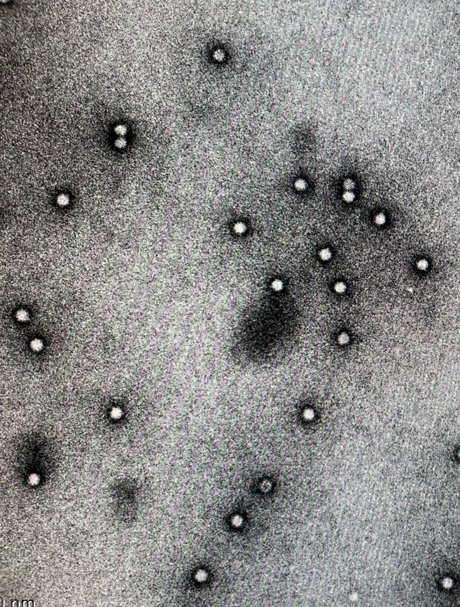 cryomariena's tweet photo. Not too shabby! #negativestain #samplescreening #thoseparticlestho #virus https://t.co/HyOhWddUom