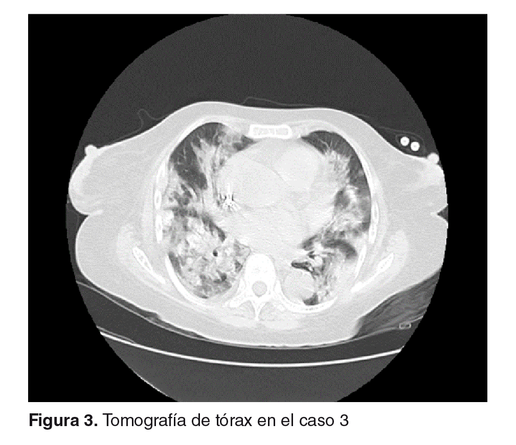 Biomedica_INS's tweet photo. 😷 COVID-19 en pacientes en hemodiálisis en Colombia: reporte de siete casos. https://t.co/YKA3lwpjx2 https://t.co/C3mWkPhW3M
