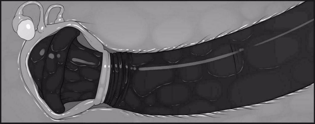 RoseFutaGoddes1's tweet photo. X-ray of how rose dose not care how tight that little hole of your is she will use you as she see fit. https://t.co/MXrtZACsns