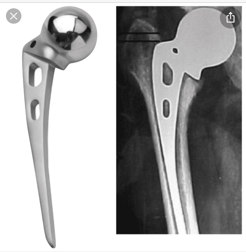 Houston Methodist Joint Replacement tweet media