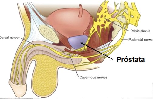 Fibrom uterin patologie