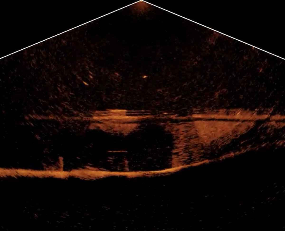 mike_Iaconelli's tweet image. SO SO SO STOKED to put the NEW @LowranceFishing Active Target transducer on my boat! This is gonna be a GAME CHANGER for me when I’m looking for fish! #activetarget #lowrancefishing #goingike #gamechanger