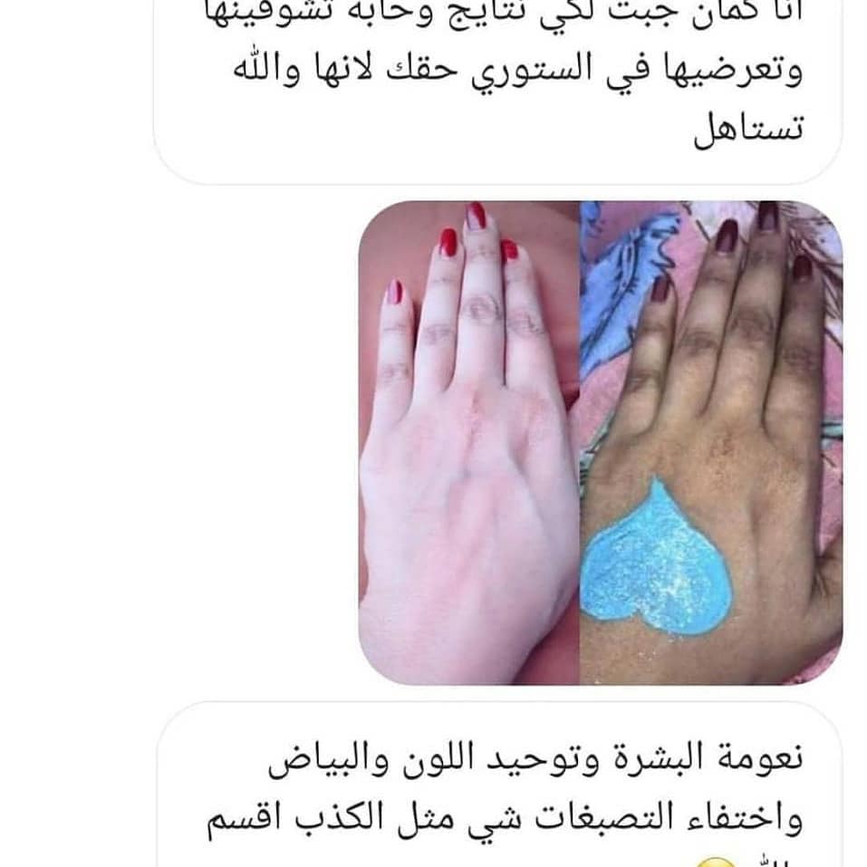 dait_rose111's tweet photo. تبارك الله 😍😍#عروض_اليوم #دعم #فولو #دعم_حسابات #عناية_عروس #عنايتي #إلا_رسول_الله #ملابس #سوق #الرياض #كورونا #تعقيم #تبييض #تفتيح #خلطات #عناية_بالبشرة #عناية_بالجسم #عناية_و_جمال https://t.co/UzF8hnlhaK