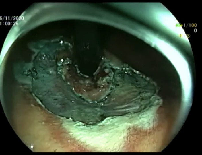 Torsten Beyna tweet media