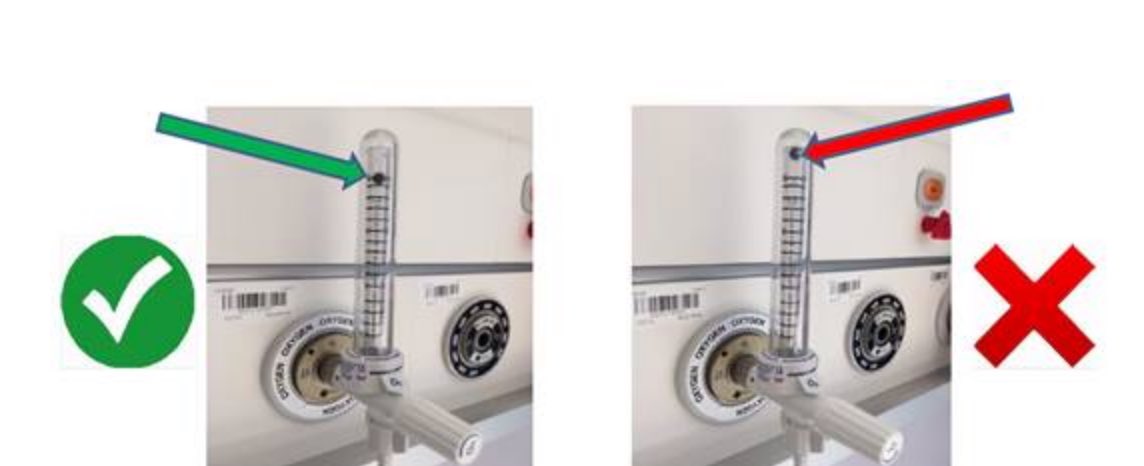 Oxygen flow is read from the centre of the ball on the flowmeter (Fig 1 = 15LPM). If you open the valve fully and the ball is higher (Fig 2) the flow of oxygen can be in excess of 45LPM 😳 Keep your eye on the ⚽️ to avoid wasting O2!
