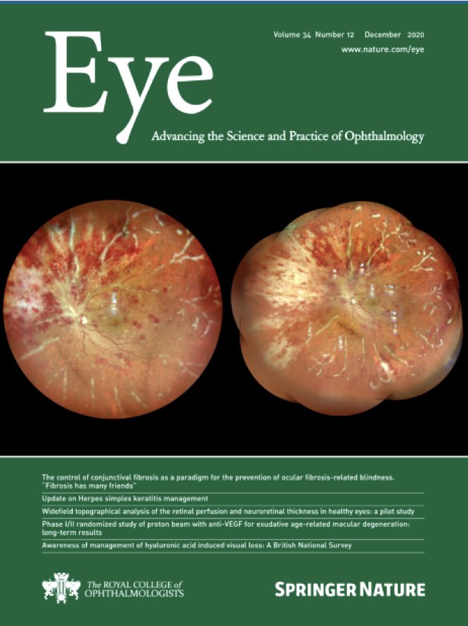 Delighted to share our latest #review published in <a href="/Eye_Journal/">Eye Journal</a> on #OCT in #neuroophthalmology. Read it here: rdcu.be/cbiSW