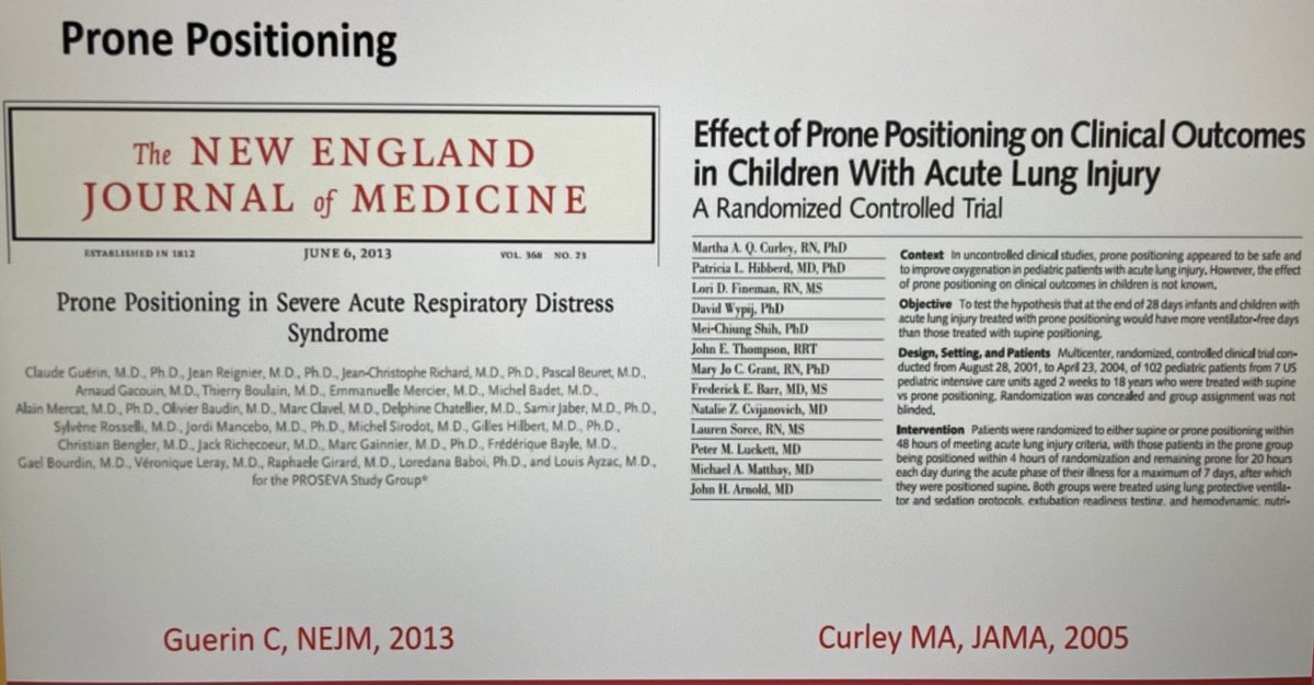 Proning is a low cost intervention with evidence of improved outcomes in adult, but this has not been reproduced in childrenThe PARDIE data shows we use proning less in Europe/USA than LMIC... surely proning is safer/easier than  #ECMO?  #PedsICU  #ARDS  #WFPICCS20