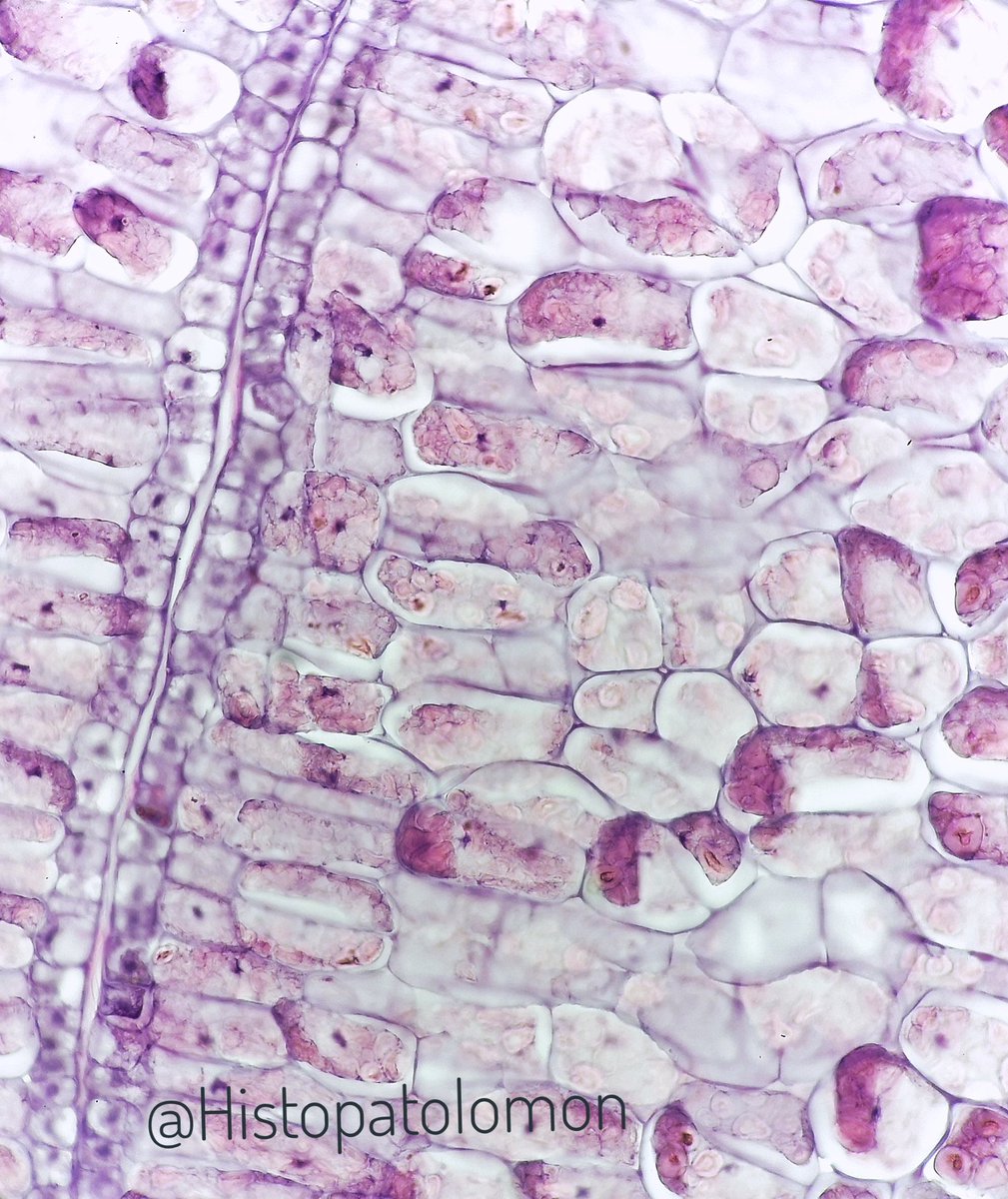 Here we can see at higher magnification, which are storage cells of a seed, it is a dried fruit.