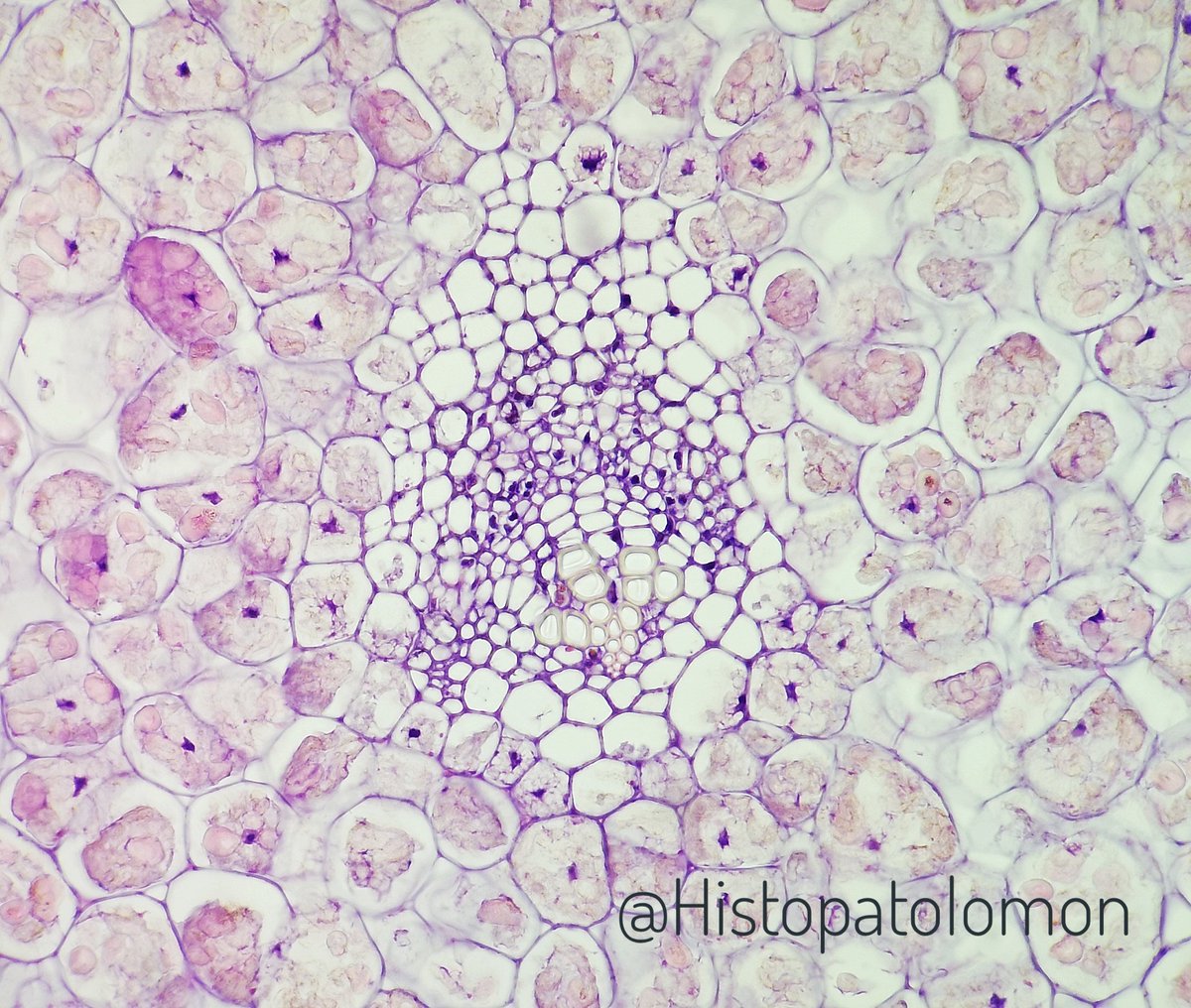 Here we can see at higher magnification, which are storage cells of a seed, it is a dried fruit.