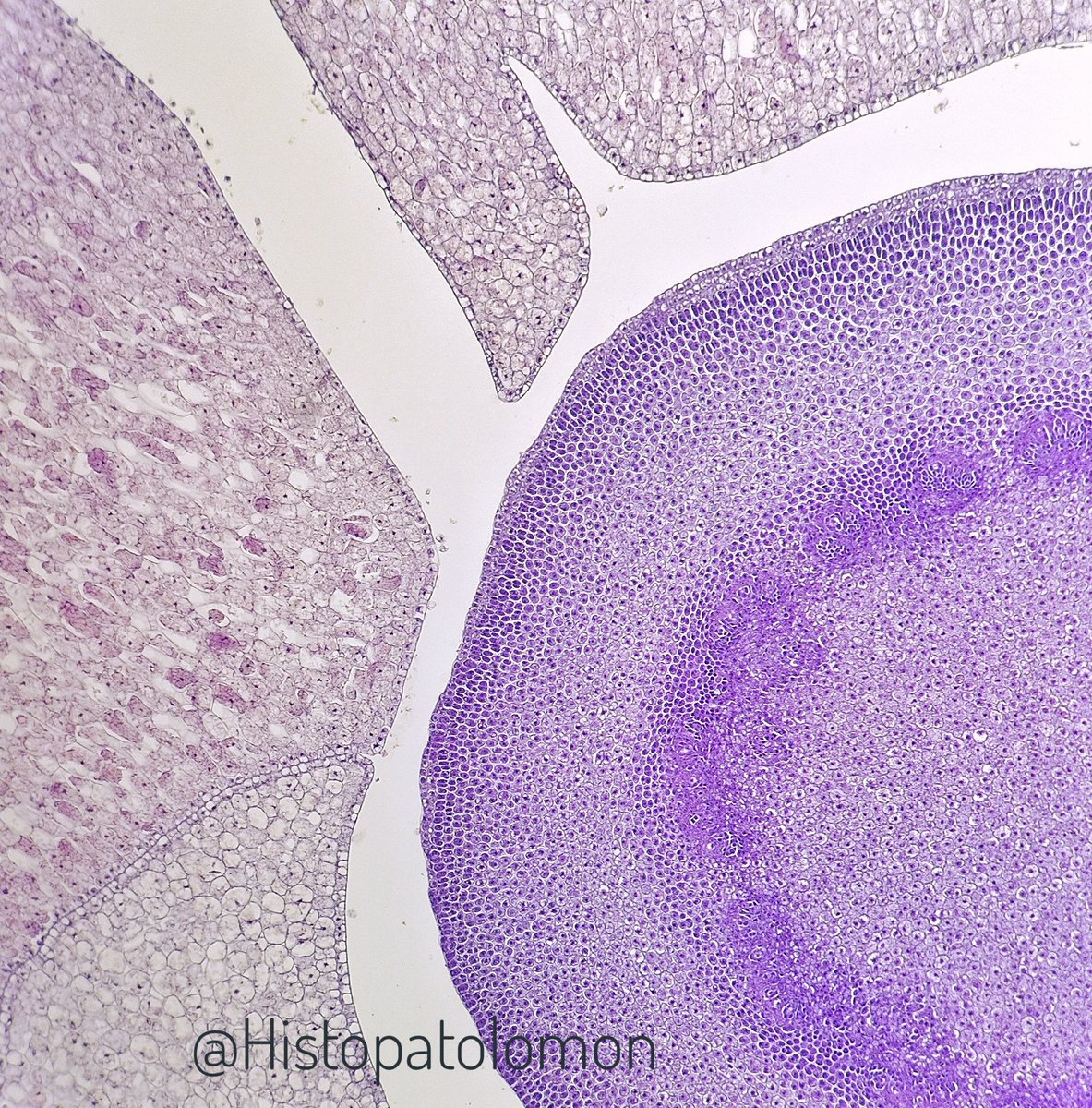 Here we can see at higher magnification, which are storage cells of a seed, it is a dried fruit.