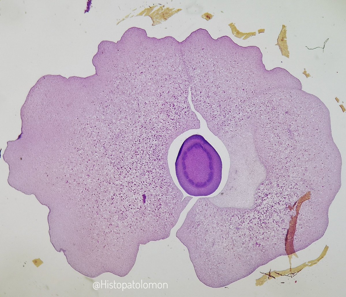 Here we can see at higher magnification, which are storage cells of a seed, it is a dried fruit.