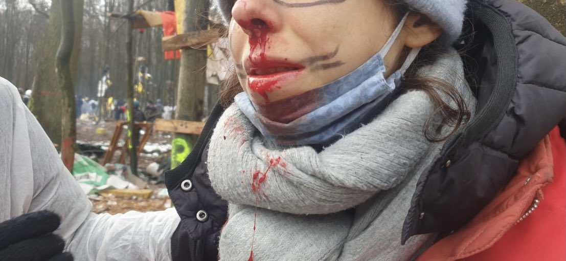 1509 Cops haben völlig den Verstand verloren. Menschen werden verletzt. Sanis nicht zu verletzten durchgelassen und es sollen auch Seile durchgeschnitten worden. 

#Polizeigewalt #Dannibleibt