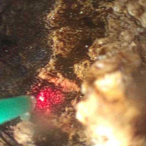 WeillCornell_IR's tweet photo. @WBrowneVIR and IR/DR @waynecolizza helping a non-op patient get rid of a large stone. Stage it with upsize of chole tube 4-6 weeks after infx resolves, scope + lithotripsy in 2-4 weeks, 2 week f/u to check/cap the tube, then remove 2 weeks after! #irad #withoutascalpel @SIR_ECS https://t.co/EwGQroSYVZ