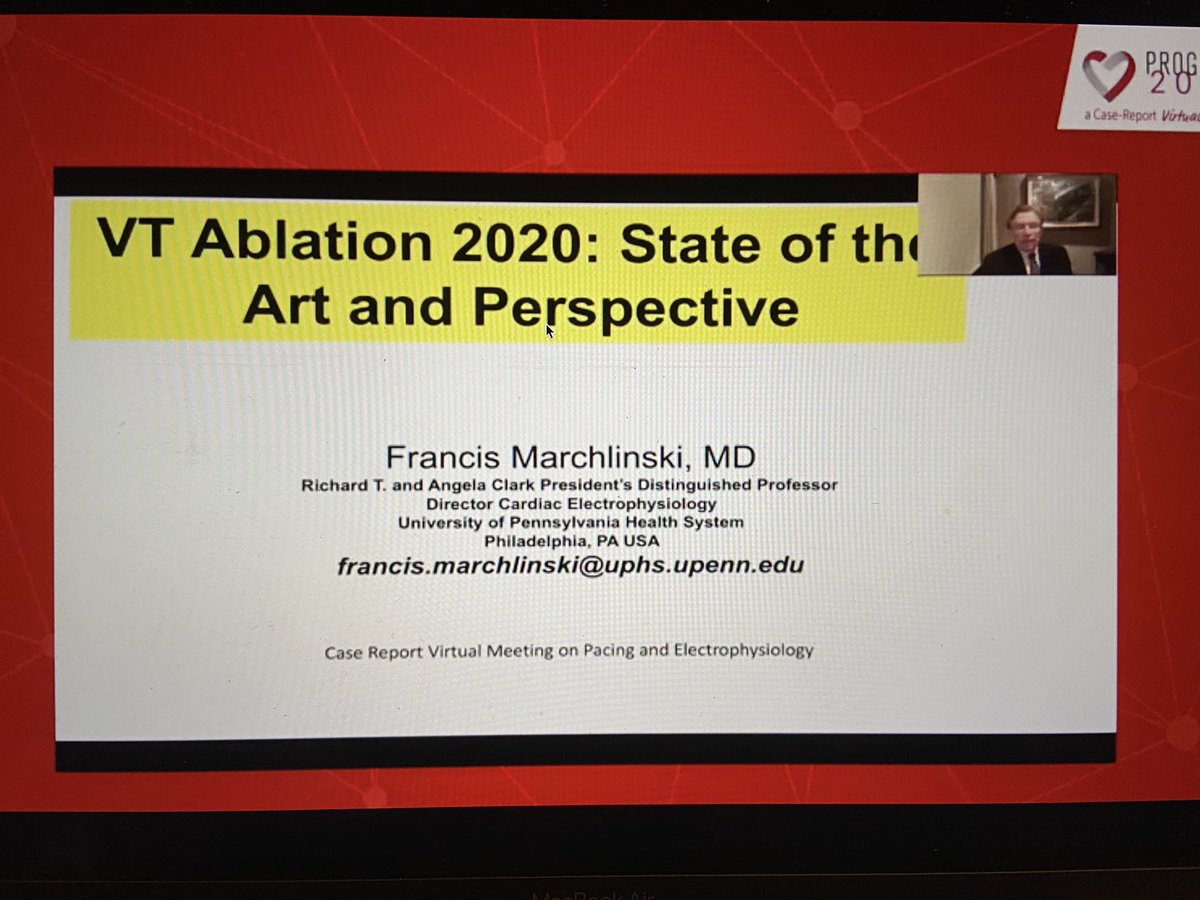 AiaClazio's tweet photo. #vt @EPeeps_Bot #progress2020 🔴on air🔴 https://t.co/yFK1LAQ1QH