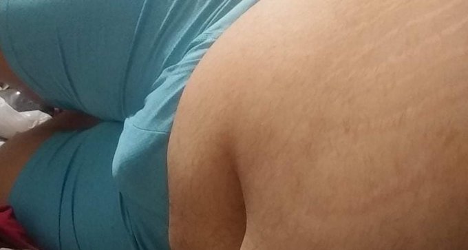 If you love yourself, you don't care what your body looks like, you still appreciate it all the same