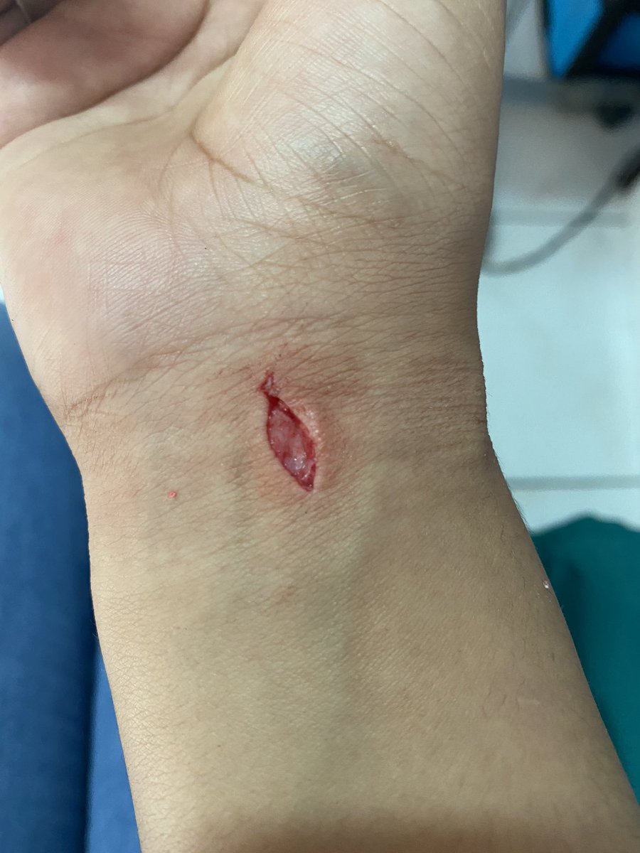nicol_obando98's tweet photo. Lo que le faltaba a mi 2020🥺
¿Quien putas se corta así sacando la basura?🤦🏽‍♀️🤦🏽‍♀️
Quede con 3 puntos antes de navidad😢😢 https://t.co/R9UYoS7JGA