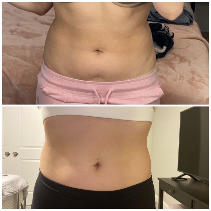 Nervous to post this but proud of my progress. It may not look like a lot to you but it&rsquo;s a lot to me