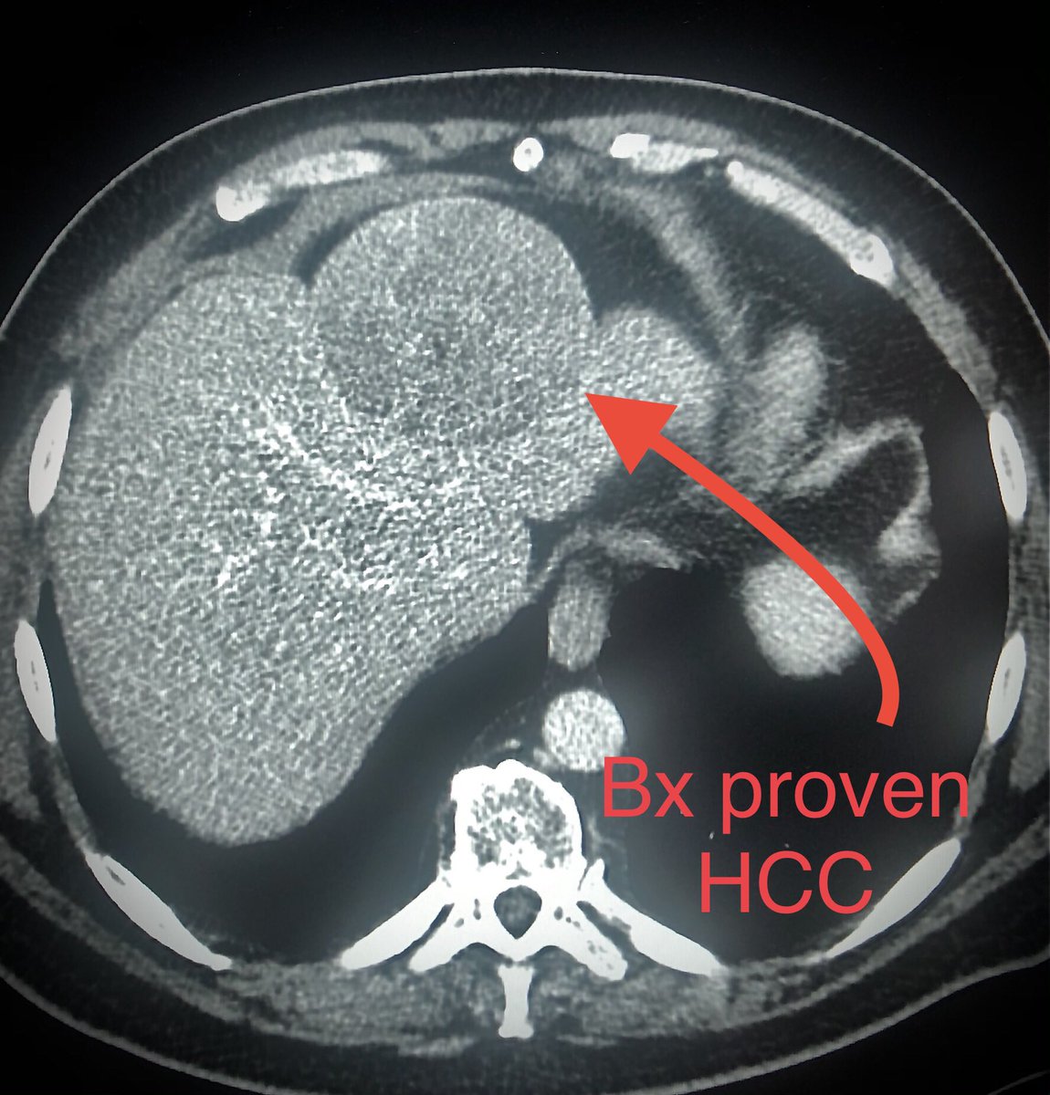 zachary masi tweet media
