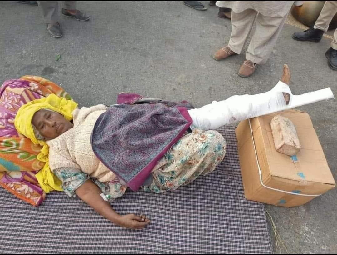 Her leg got fractured during protest in Delhi but still she is protesting with farmers and denied to go back home. @KangnaRanaut___ @diljitdosanjh #8दिसंबर_भारत_बंद #5दिसंबर_भारत_बंद #SpeakUpForFarmers