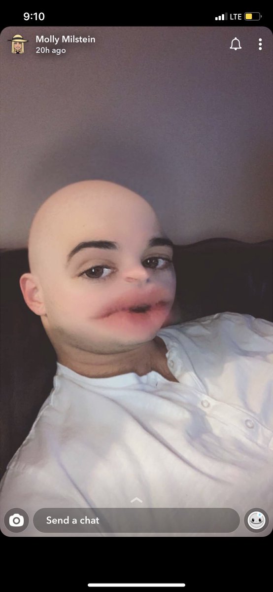 Daryn Snow™ tweet media